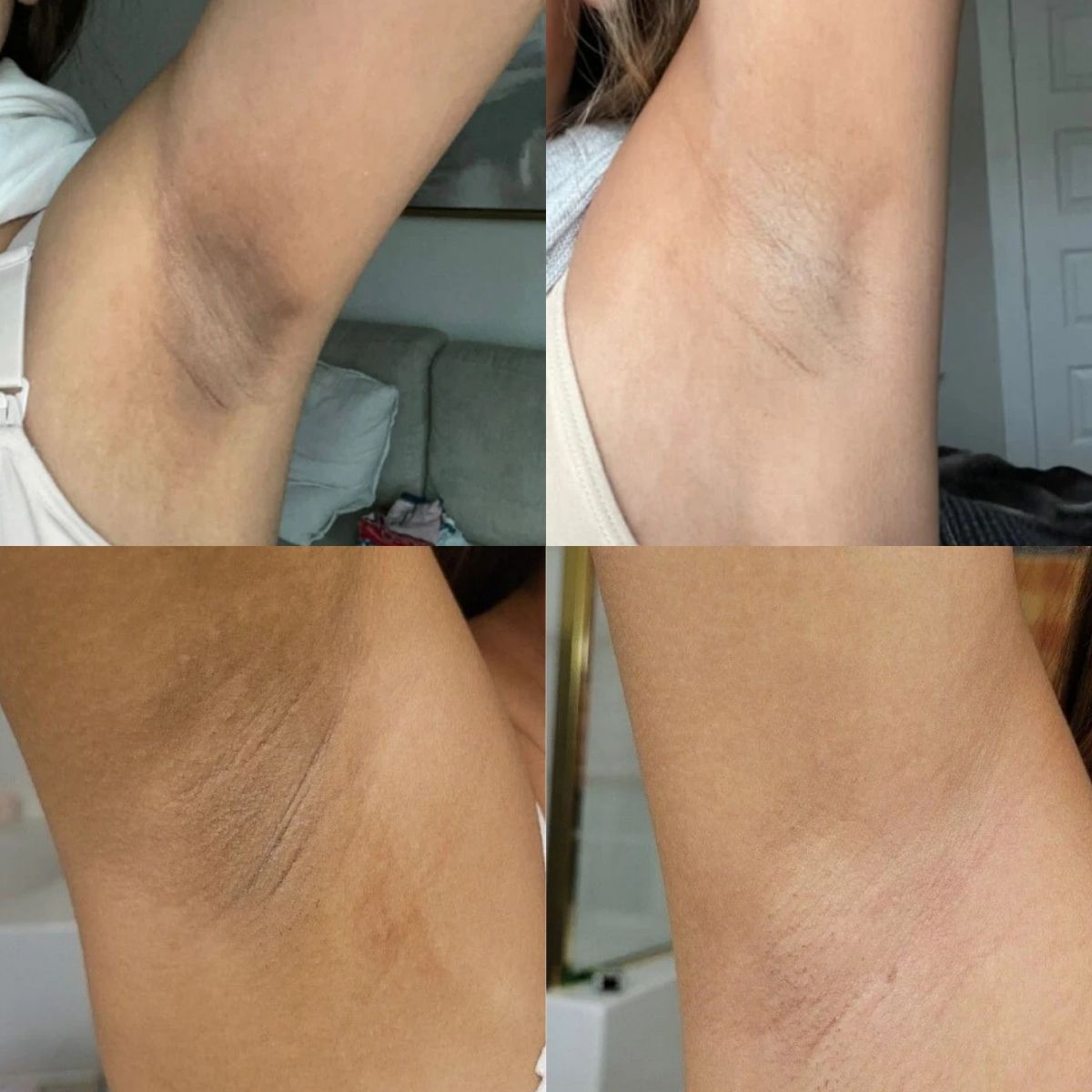 Peel Shot Tumereci ексфолиращ спрей