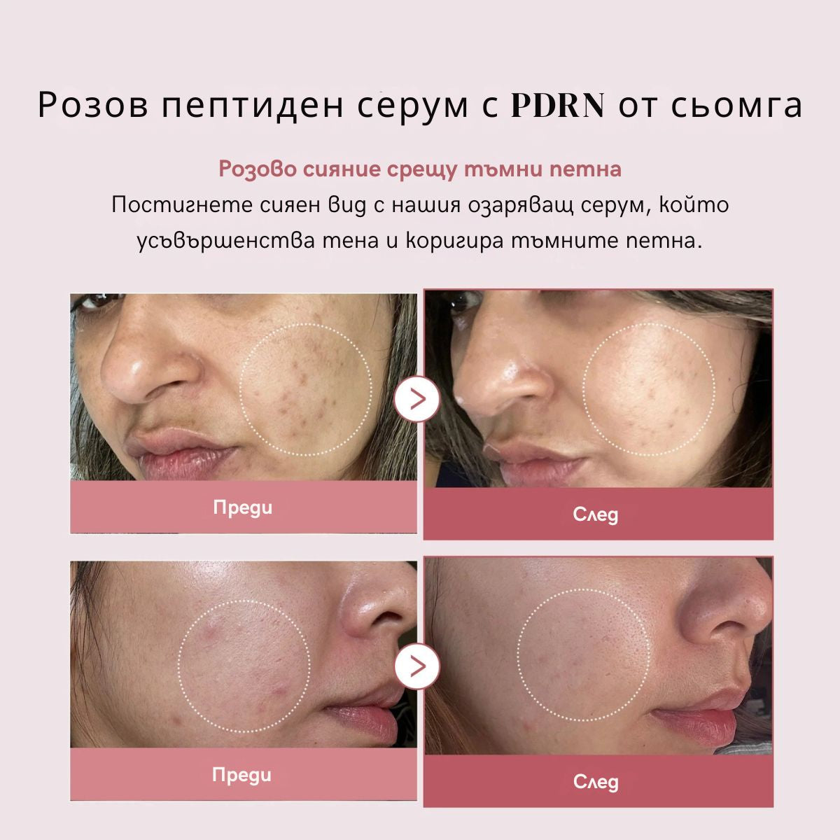 PDRN Pink Serum Peptide – Дълбока хидратация, "Glass Skin" ефект