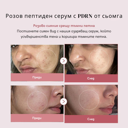 PDRN Pink Serum Peptide – Дълбока хидратация, "Glass Skin" ефект
